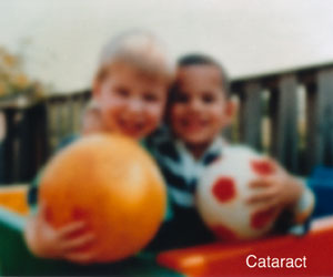 Cataract Vision