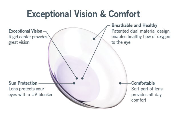 Synergeyes Hybrid Contacts